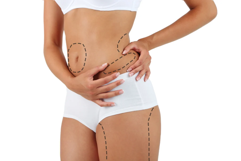 Antalya liposuction fiyatları Antalya liposuction fiyatları